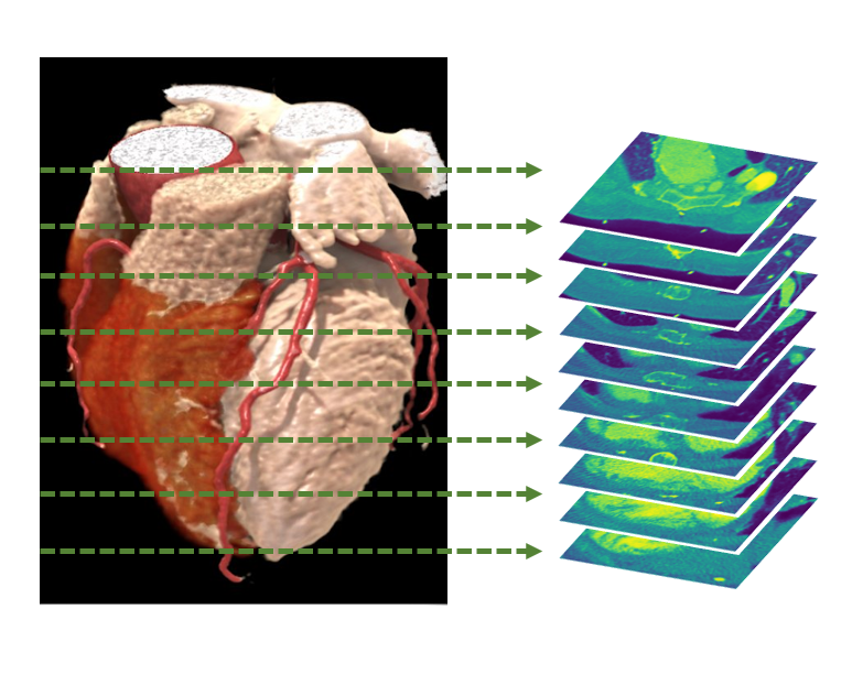 Illustration for the code: AutoEncoderHeartCT